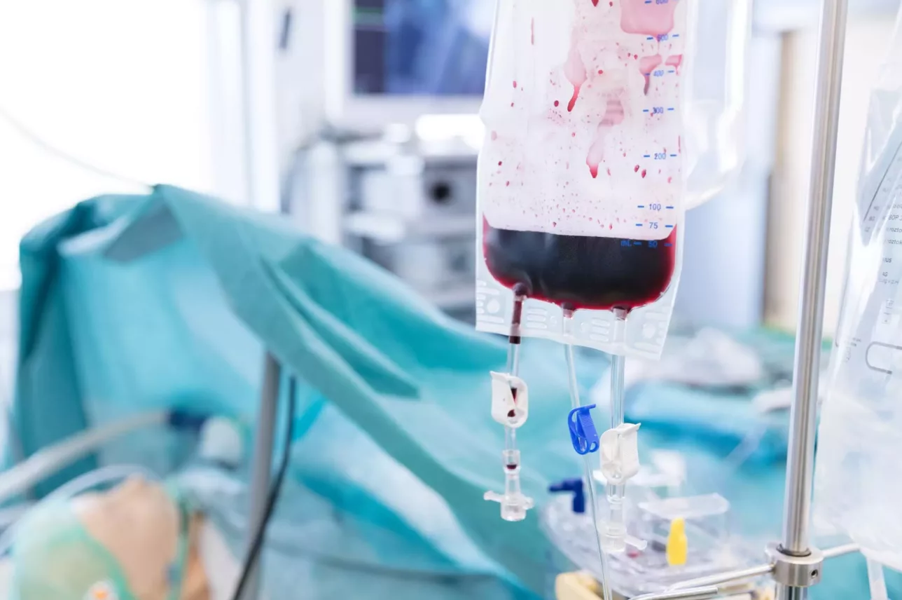 Eine Nahaufnahme eines Bluttransfusionsbeutels mit Schläuchen, der an einem Infusionsständer in einem Krankenhauszimmer hängt. Im Hintergrund sind medizinische Geräte und ein mit einem blauen OP-Tuch bedeckter Patient zu sehen.